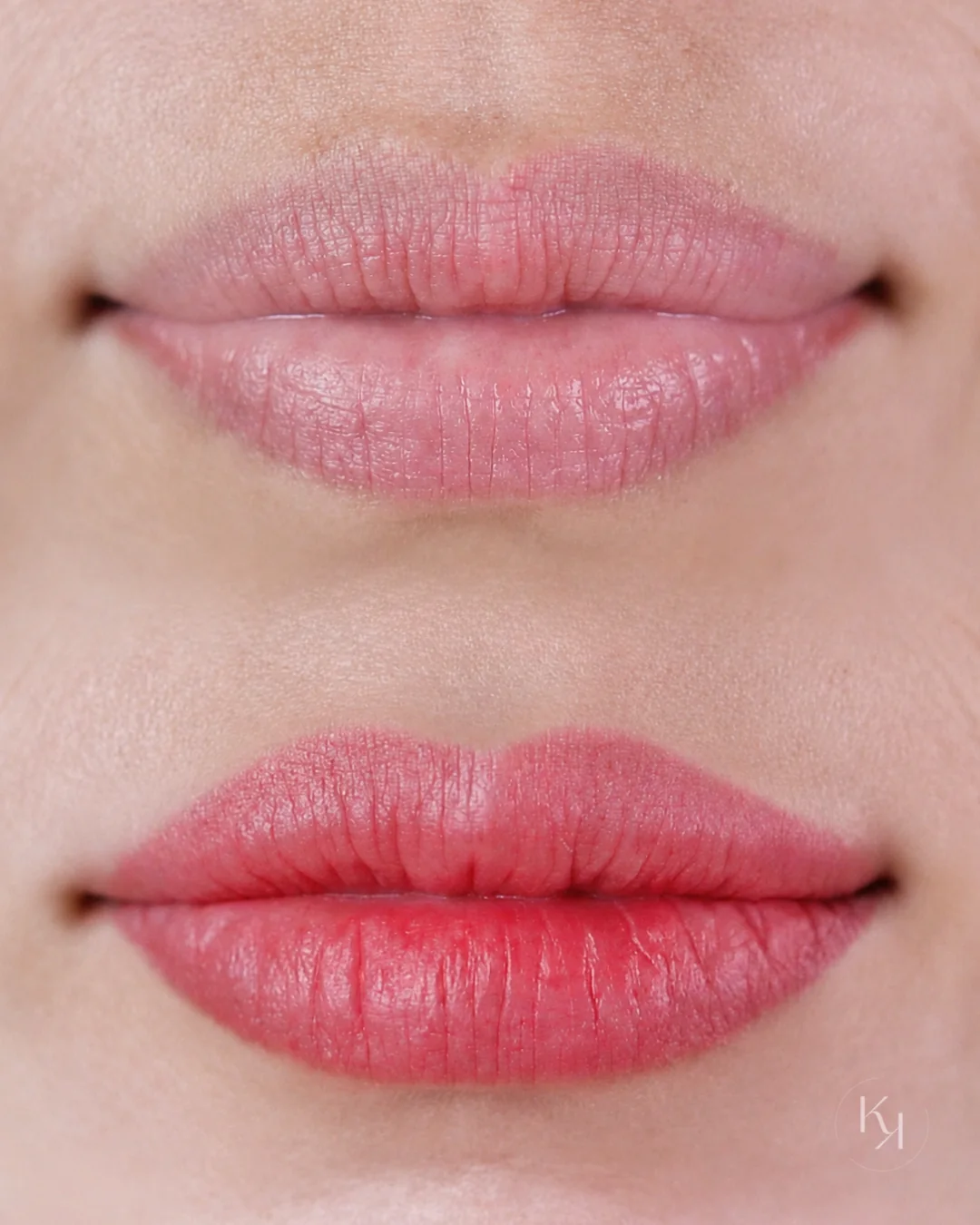 Curso Pure Lips para lábios